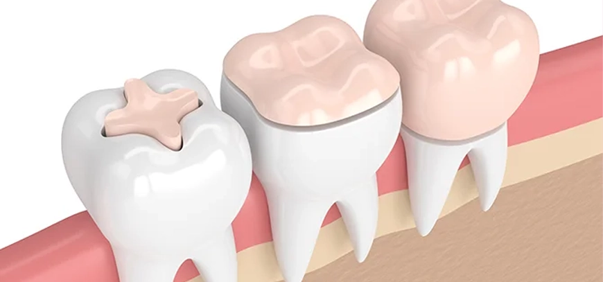 restorative dentistry in basheerbhag